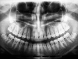 Mejores Férulas Dentales ortodinamics.com